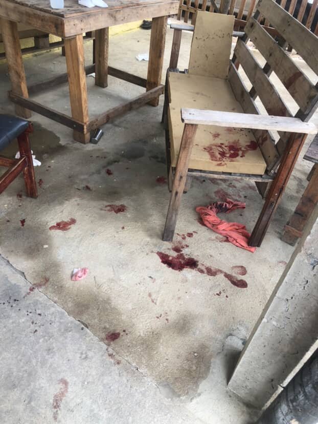 Bebê é atacado por pitbull em Campos e passa por cirurgia no Hospital Ferreira Machado